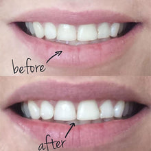 Load image into Gallery viewer, 100% Natural Teeth Whitening
